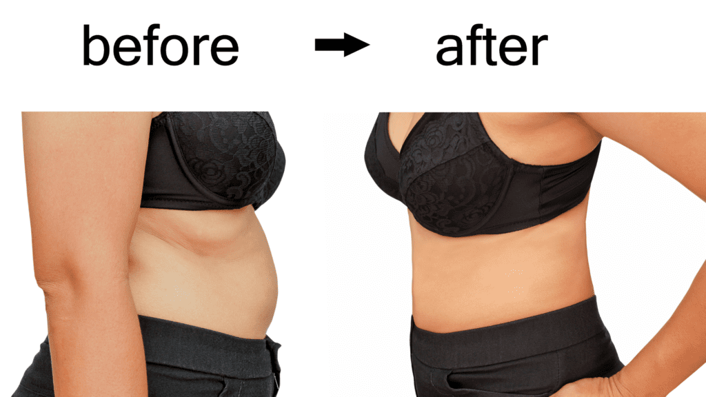 fat killer before after